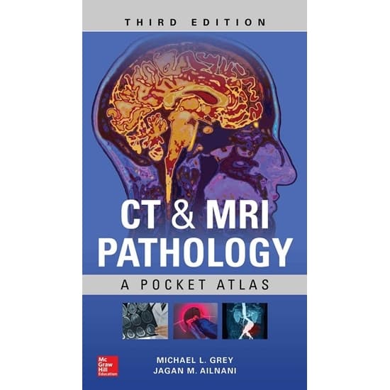 Bệnh Lý Học CT & MRI - Atlas Bỏ Túi
